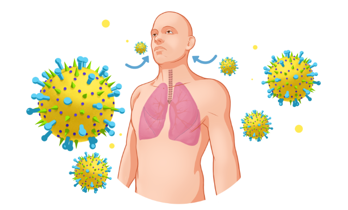 Попадание вируса в лёгкие.